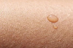 پاکسازی تخصصی پوست
