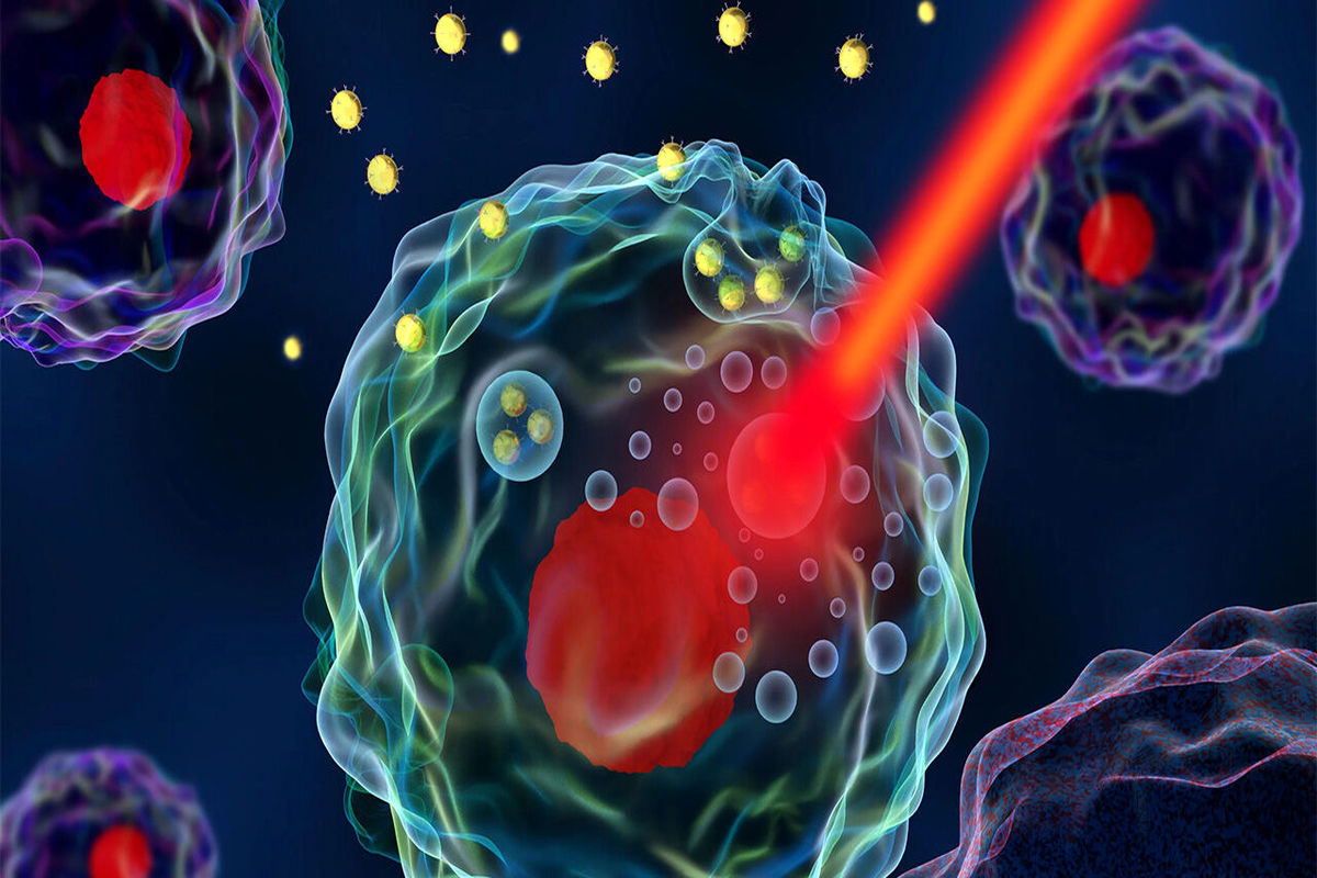 نانوذرات از سلول های سرطانی محافظت می کنند 