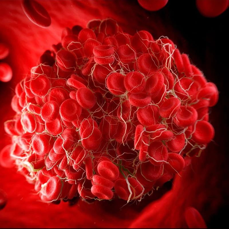 What is the sign of high hemoglobin?