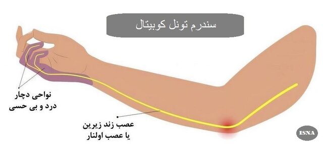 خطرات رفیق دیجیتال برای سلامتی و سبک زندگی