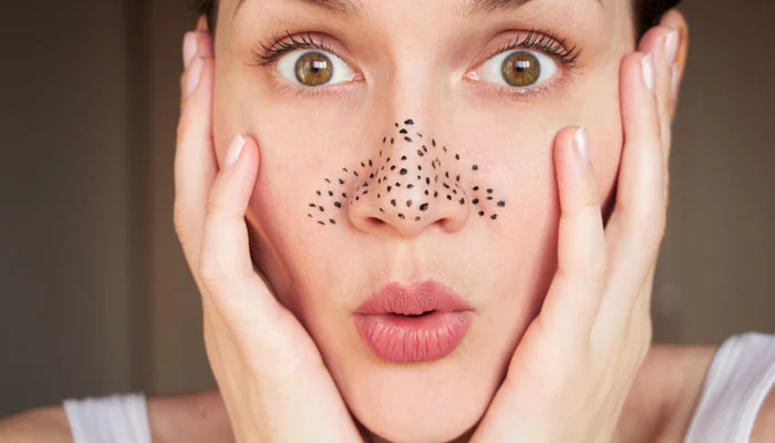 The scrub removes blackheads