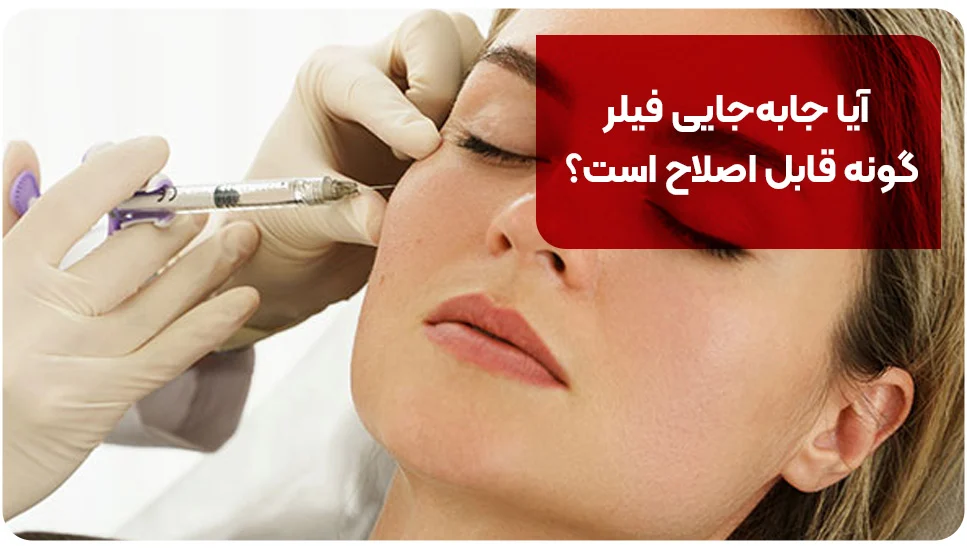 آیا جابهجایی فیلر گونه قابل اصلاح است؟