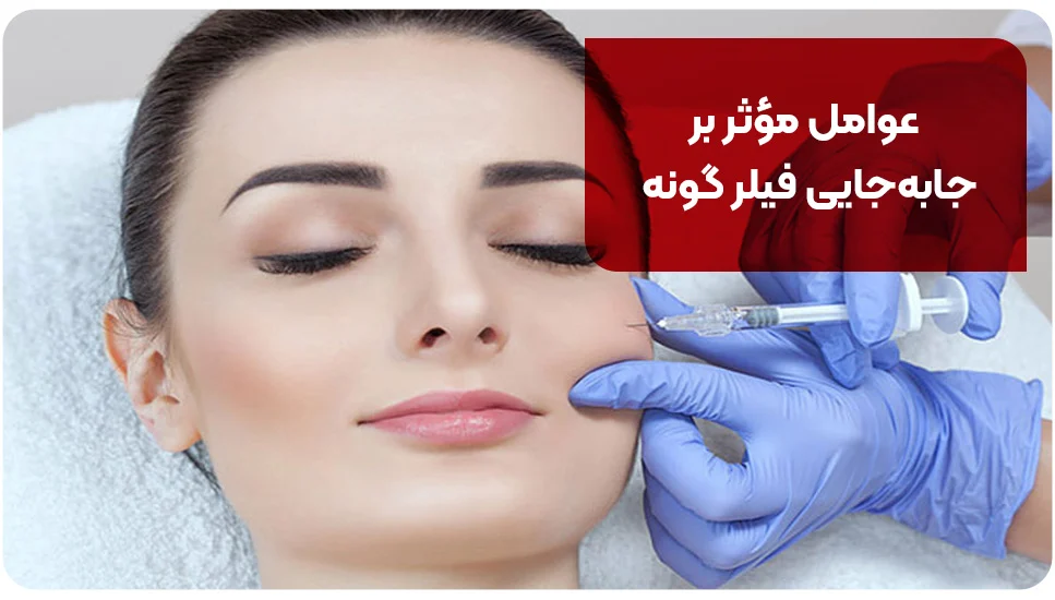 عوامل مؤثر بر جابهجایی فیلر گونه