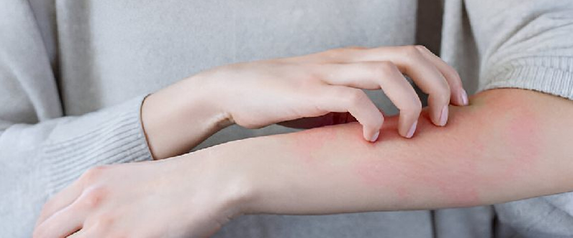 نقش کرمهای ضد قرمزی در بازسازی سد دفاعی پوست